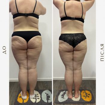 Вікторія Доценко, Харків Фото - 13