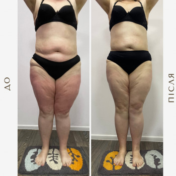 Вікторія Доценко, Харків Фото - 14