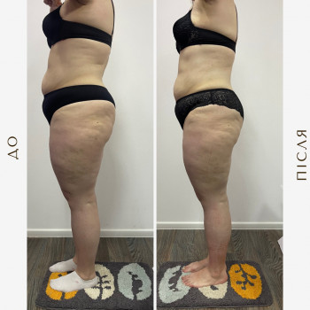 Вікторія Доценко, Харків Фото - 15