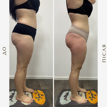 Вікторія Доценко, Харків Фото - 19