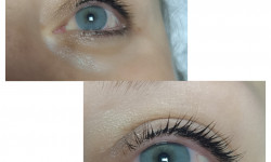 Ламинирование ресничек + filler Косметолог-эстетист Екатерина Кременчуг