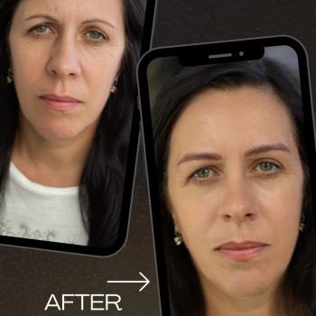 Волосковая техника перманента бровей
                    Салон красоты Mona Lisa Полтава