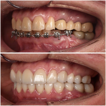 Фото з портфоліо клініки Адамар (стоматологічна клініка, Мукачево)