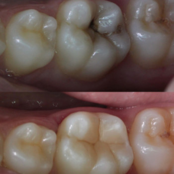 Катерина Кобака, Мукачево Фото - 5