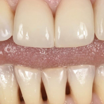 Enamel, Мукачево Фото - 5