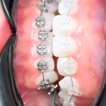 Smile Gallery, Мукачево Фото - 5