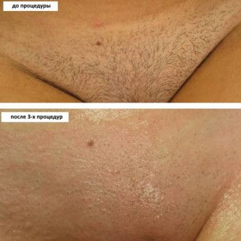 До та після