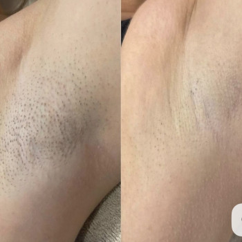 До та після