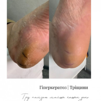 Катерина Терпеливець, Хуст Фото - 5