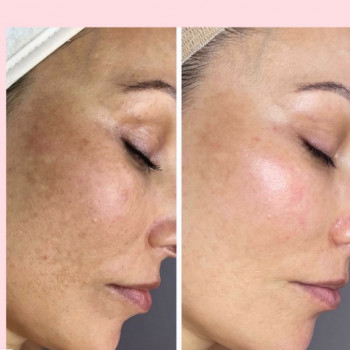 Наталія Савостянова, Хуст Фото - 5