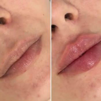 Зіта Томищ, Хуст Фото - 5