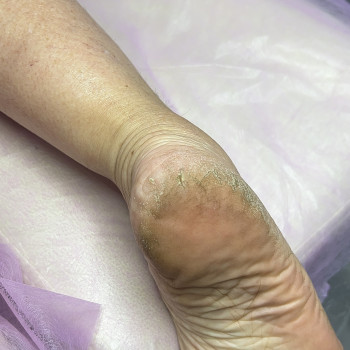 Подологічні послуги
                    Майстер манікюру Дарья Сміла