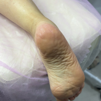 Подологічні послуги
                    Майстер манікюру Дарья Сміла