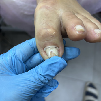 Подологічні послуги
                    Майстер манікюру Дарья Сміла