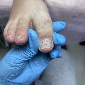 Подологічні послуги
                    Майстер манікюру Дарья Сміла