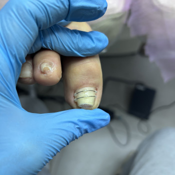 Подологічні послуги
                    Майстер манікюру Дарья Сміла