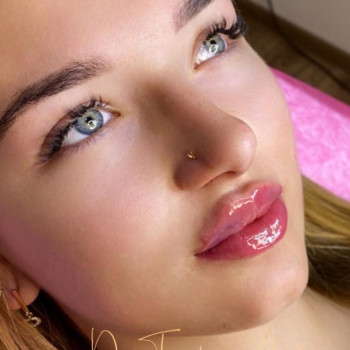 Sonomed, Хуст Фото - 5