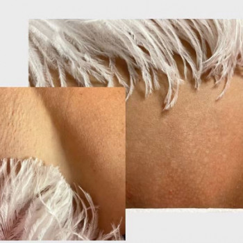 Pero, Хуст Фото - 5