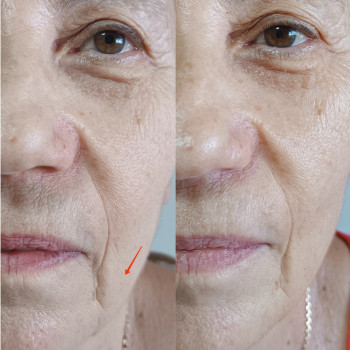 Марина Мишлякова, Одесса Фото - 10