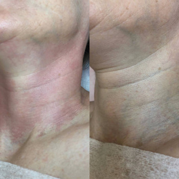 Ирина Колімбет, Полтава Фото - 12