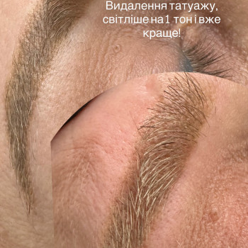 Ирина Колімбет, Полтава Фото - 9