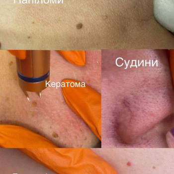 Ирина Колімбет, Полтава Фото - 3