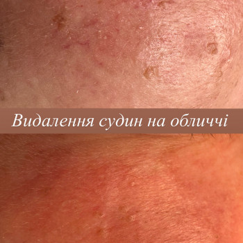 Ирина Колімбет, Полтава Фото - 24