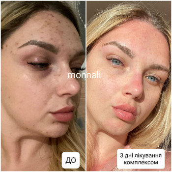 Monnali, Київ Фото - 2