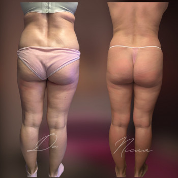 Аліна Темченко, Луцьк Фото - 11