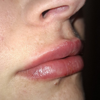 Ольга Сорокопуд, Миколаїв Фото - 14