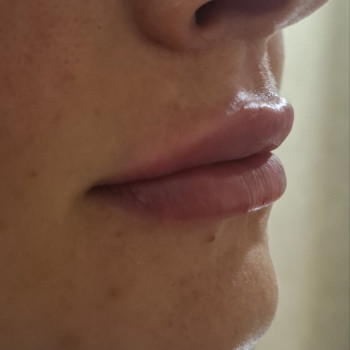 Ольга Сорокопуд, Миколаїв Фото - 13