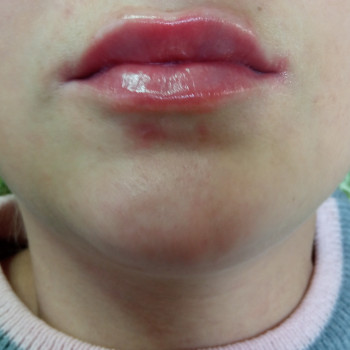 Ольга Сорокопуд, Миколаїв Фото - 6