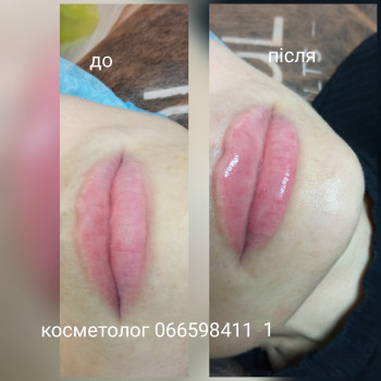 Ольга Сорокопуд, Миколаїв Фото - 4