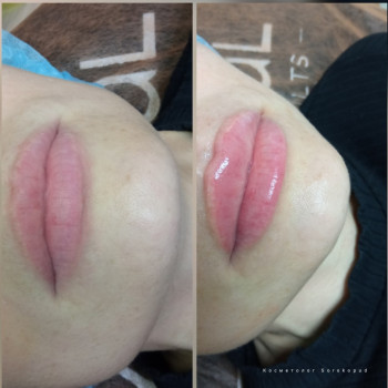 Ольга Сорокопуд, Миколаїв Фото - 3