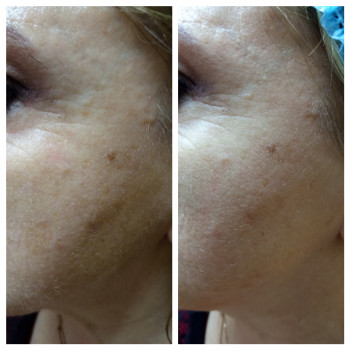 Ольга Сорокопуд, Миколаїв Фото - 17