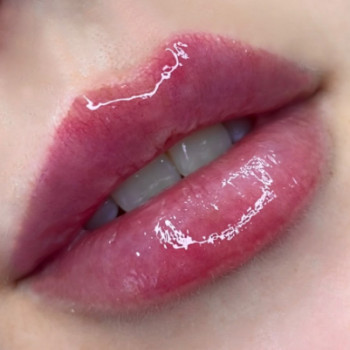 Инна Богачук, Луцк Фото - 5