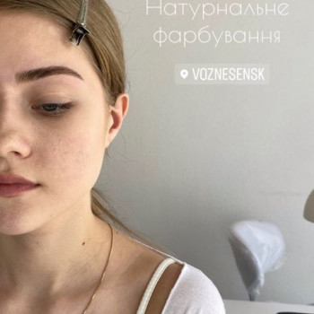 Garni, Вознесенськ Фото - 6