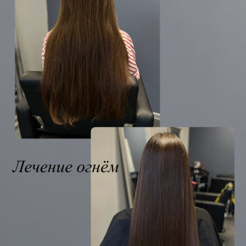 Лікування вогнем модель у Ризі