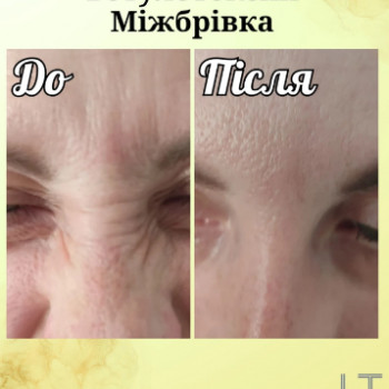 Людмила Торчинюк, Луцк Фото - 5