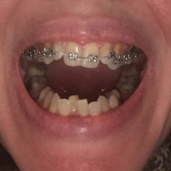 Початкова ситуація