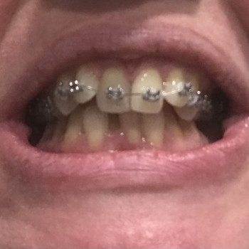 Початкова ситуація