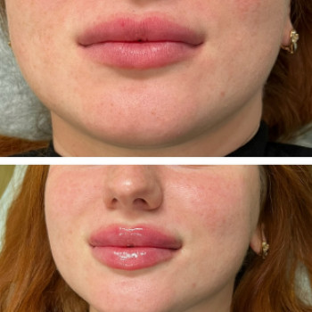 Кристина Проц, Луцк Фото - 5