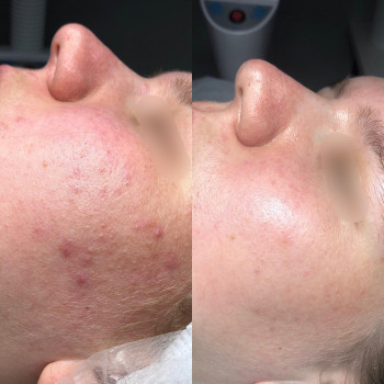 Виктория Бусел, Луцк Фото - 5