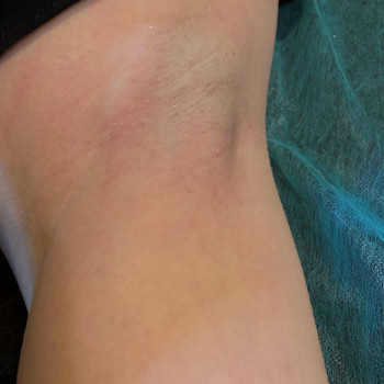 Тетяна Кайстро, Днепр Фото - 4