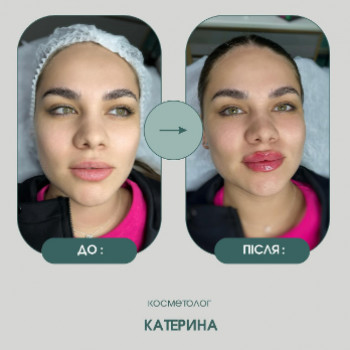 Екатерина Колесник, Луцк Фото - 5