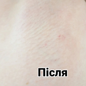 Мар'яна Галюк, Луцьк Фото - 5