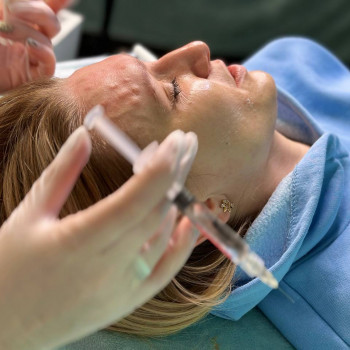 БІОРЕВІТАЛІЗАЦІЯ ОБЛИЧЧЯ
                    Косметолог Елена Винница