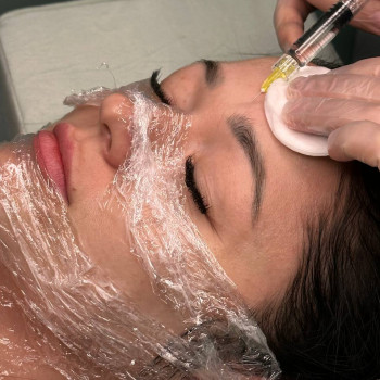 БІОРЕВІТАЛІЗАЦІЯ ОБЛИЧЧЯ
                    Косметолог Елена Винница