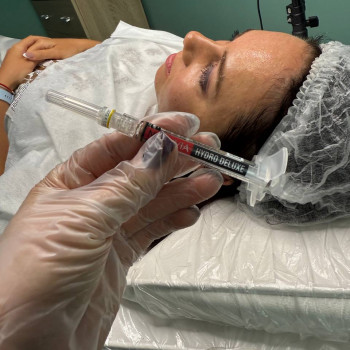 БІОРЕВІТАЛІЗАЦІЯ ОБЛИЧЧЯ
                    Косметолог Елена Винница