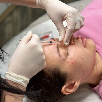 БОТУЛІНОТЕРАПІЯ
                    Косметолог Елена Винница